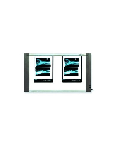 Négatoscope extra plat 2 plages écran 74x445cm