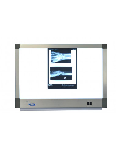 Négatoscope standard 2 plages écran 72x43,5cm 2X45W