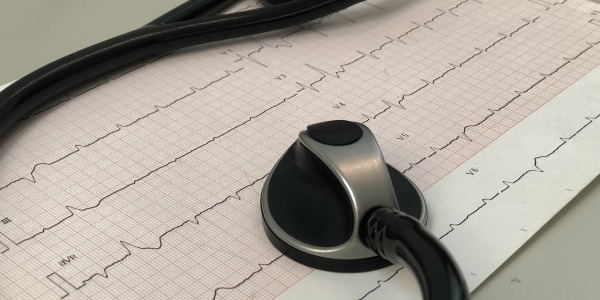 L’ECG ou électrocardiogramme, un examen médical qui peut vous sauver la vie !